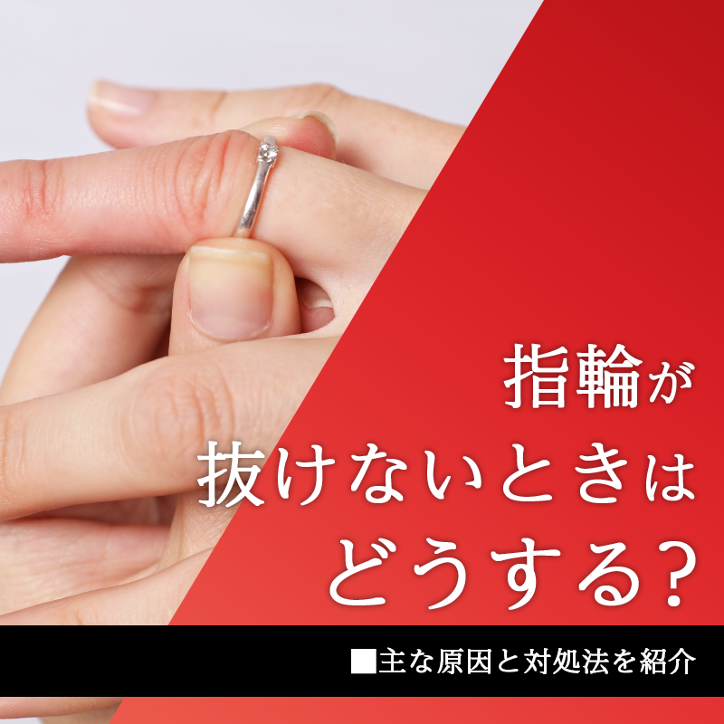 指輪が抜けないときはどうする？主な原因と対処法を紹介